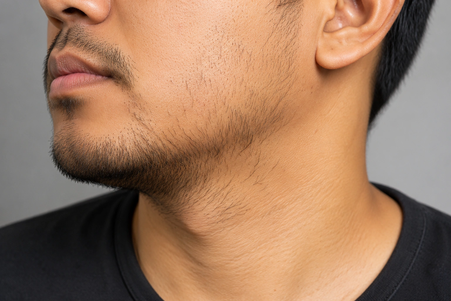 Sweaty Hands Affecting Your Daily Life? Explore Effective Hyperhidrosis Treatments